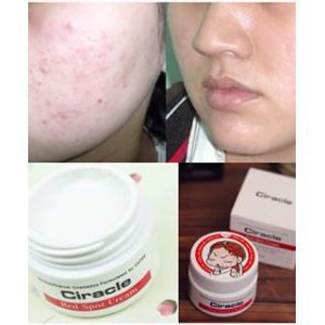 Ciracle Red Spot Cream [Sạch mụn 100%-Hàng Auth]  Kem Ciracle giảm mụn, xóa mờ vết thâm, trắng da hiệu quả