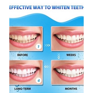 Miếng dán trắng răng Crest 3D Whitening