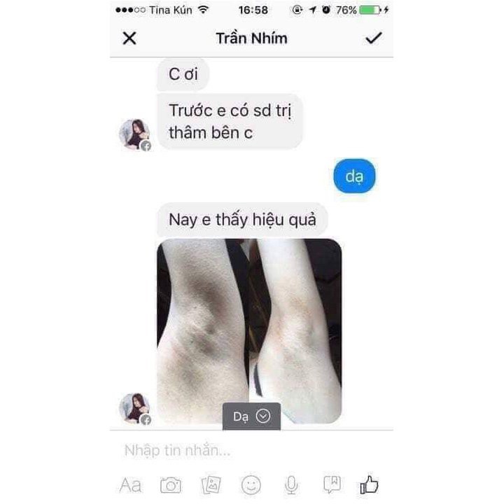 (CHÍNH HÃNG)💝FREESHIP💝 KEM  LÀM TRẮNG NÁCH BẸN MÔNG GCELL HÀN QUỐC | BigBuy360 - bigbuy360.vn