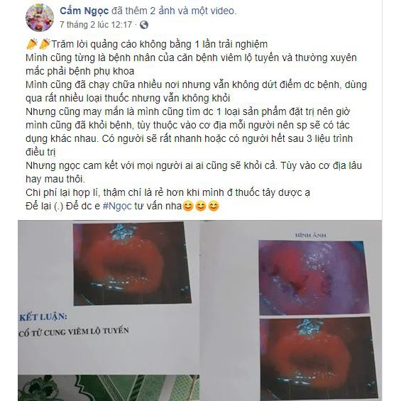 Dung dịch vệ sinh phụ nữ đũa thần tình yêu Habela, gel vệ sinh vùng kín an toàn, se khít tiện lợi 5ml