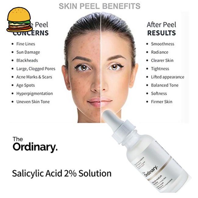 Serum The Ordinary Salicylic Acid 2% Solution. tinh chất tẩy tế bào ra chết, ngăn ngừa mụn | BigBuy360 - bigbuy360.vn