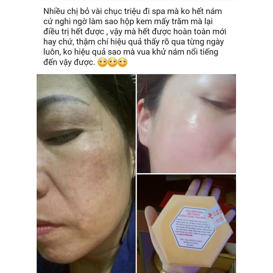 Kem Mờ Nám,Tàn Nhang Hiệu Quả Nhật Bản - Vua Khử Nám, Dưỡng Trắng, Chống Nắng Tốt -Hàng Chính Hãng Nhật Bản