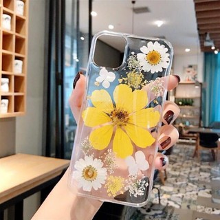 Combo 5 ốp điện thoại iphone _miumiu