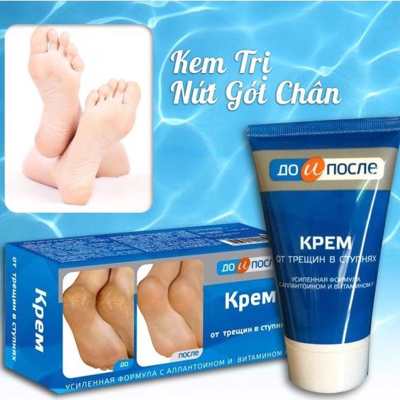 Kem giảm nứt gót chân Kpem Apteka Nga 50ml giữ ẩm cho da, làm mềm da chân