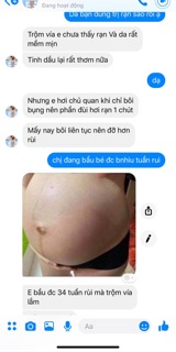 Tinh dầu trị rạn