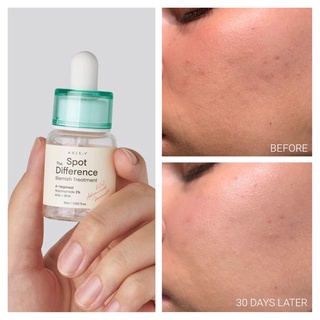 1590- Tinh Chất chấm Mụn, Mờ Thâm AXIS-Y Spot The Difference Blemish Treatment 15ml ( #axisy)