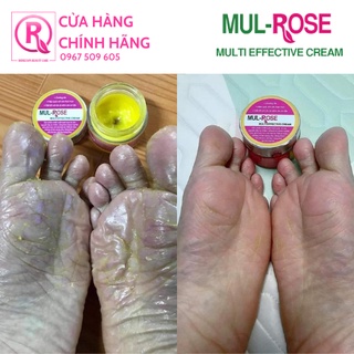 Combo 5 Kem đa năng MUL-ROSE