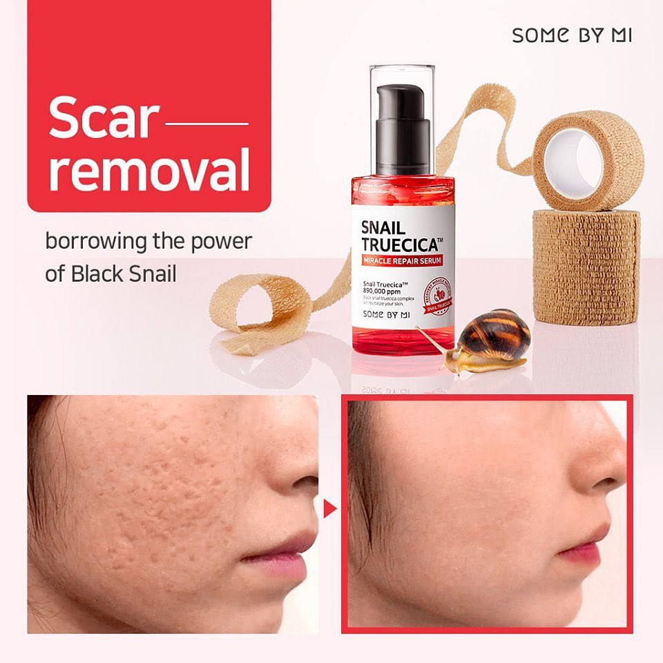 [CHÍNH HÃNG] Tinh chất ốc sên Some By Mi Snail Truecica Miracle Repair Serum 50ml | BigBuy360 - bigbuy360.vn