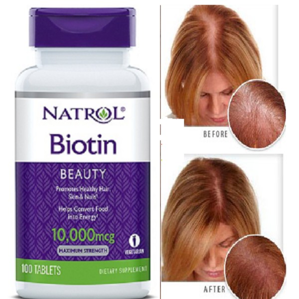 Viên uống mọc tóc Natrol Biotin 10,000mcg Maximum Strength 100 viên