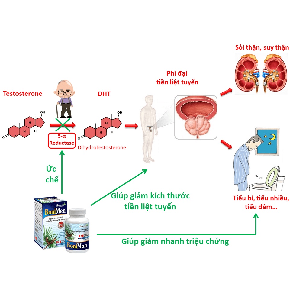 BoniMen (Hộp 30 viên) - Giảm phì đại tuyến tiền liệt