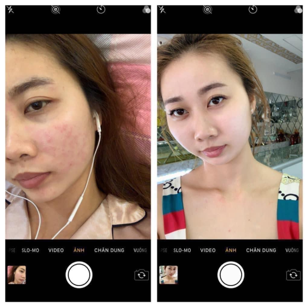 Kem Nuly Baby dưỡng da trắng đẹp