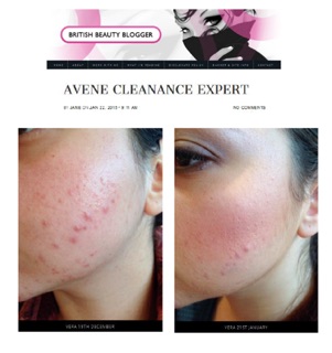 Kem trị mụn trứng cá Avene Triacneal Expert Emulsion 30ml
