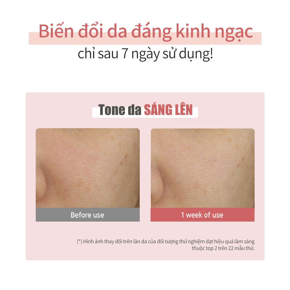 Tinh chất hoa hồng làm mờ thâm mụn & dưỡng sáng Mamonde Rose Blemish Clearing Serum 30ML