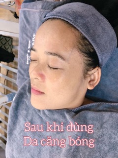 Serum glutathione 700