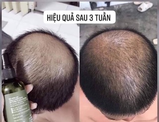 Combo 3 Chai Tinh Dầu Bưởi Vi Jully