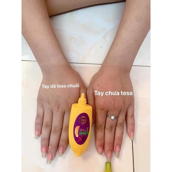 CHUỐI CẤY TRẮNG THẢI CHÌ | BigBuy360 - bigbuy360.vn
