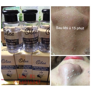 Tinh chất ủ trồi mụn