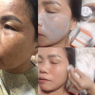 Ol-cell cải thiện mụn Thâm Nám hàn quốc