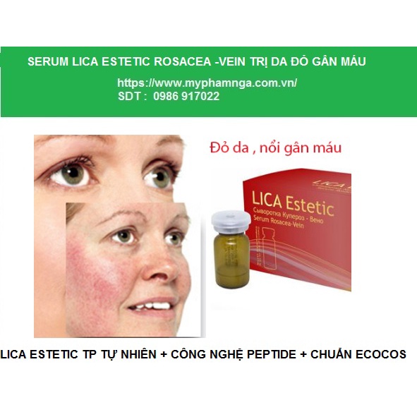 (ĐỎ,GÂN MÁU)Serum Lica Estetic Rosacea-Vein dưỡng da mỏng đỏ, nổi gân máu, quầng thâm, giãn tĩnh mạch