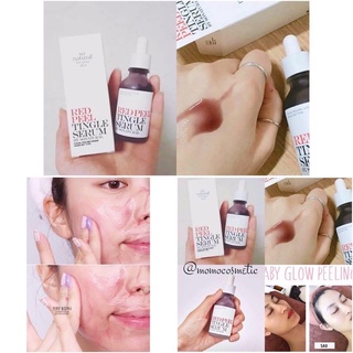Tinh chất Red Peel Tingle Serum