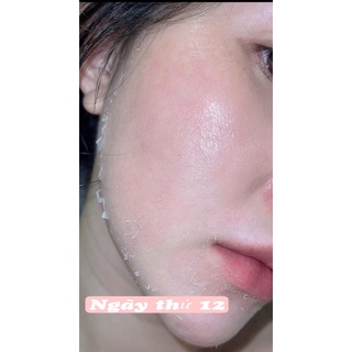 Peel da sin học Behome spa