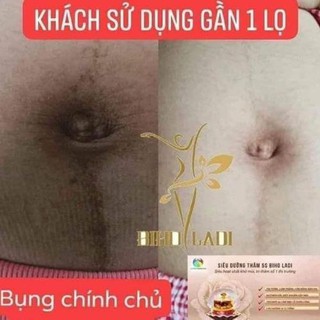 SIÊU DƯỠNG THÂM NÁCH-BỤNG-BIKINI