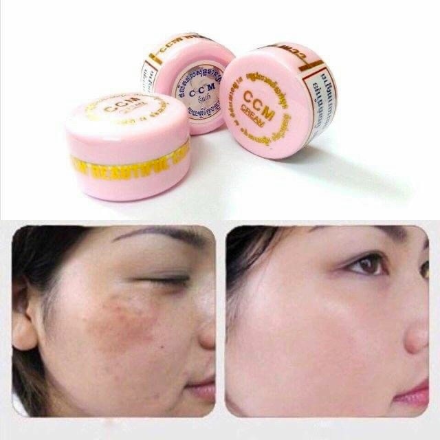 Kem Nám CCM Thái Lan