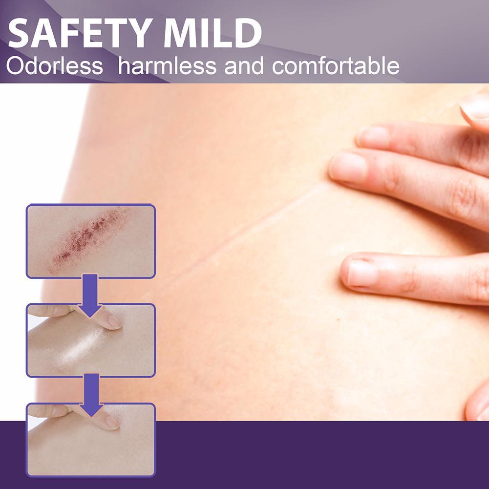 Bộ 8 Miếng Dán Silicone Hỗ trợ giảm sẹo Làm Sáng Tông Màu Da Q2T4