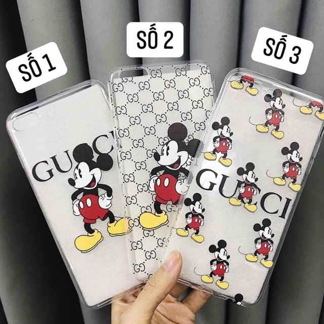 Ốp Mickey GG dẻo