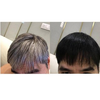 Dầu Gội Phủ Bạc Đen Tóc