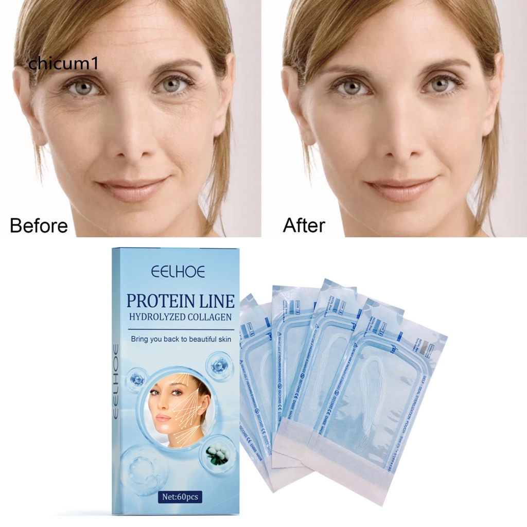 Cuộn Chỉ Collagen Mini Chống Lão Hóa Chăm Sóc Da Mặt Sử Dụng Tại Nhà