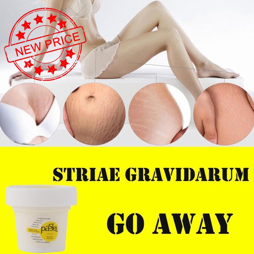 Kem Trị Rạn Da Sau Sinh Cho Phụ Nữ Mang Thai O8E2