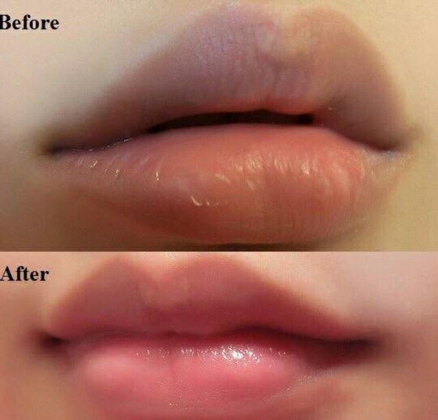 Tẩy Da Chết Môi Beauty Lip Scus | BigBuy360 - bigbuy360.vn