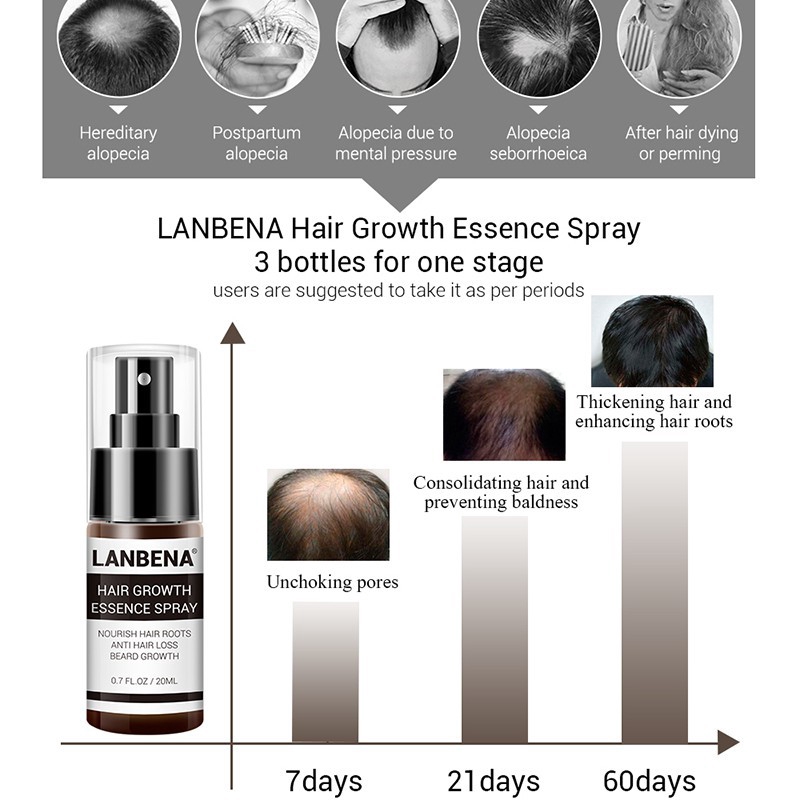 Bộ Sản Phẩm Tinh Dầu Mọc Tóc LANBENA 20ml + Tinh Chất Tăng Trưởng Tóc LANBENA Dạng Xịt 20ml | BigBuy360 - bigbuy360.vn