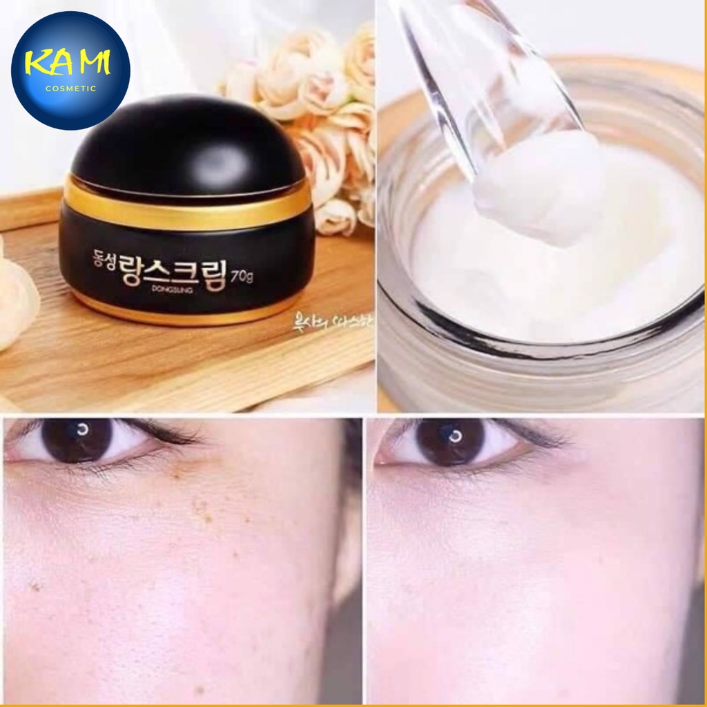 Kem nám Dongsung mẫu cũ 70gr - KAMI - dưỡng trắng da, giảm thâm nám tàn nhang dành cho mọi loại da
