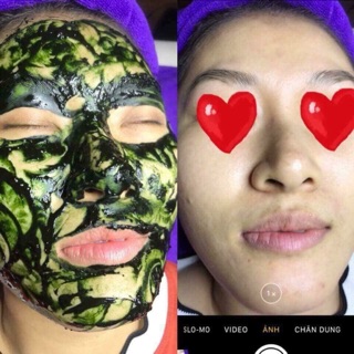 HCM [VOUCHER] CẤY TẢO XOẮN DƯỠNG ẨM MỜ THÂM TẠI Skin House