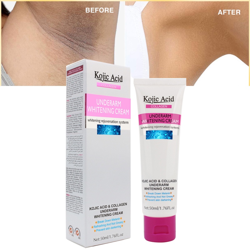 Kem làm trắng da vùng dưới cánh tay Kojic Acid 50ml