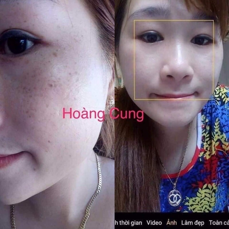 Bộ sản phẩm kem làm trắng da HOÀNG CUNG XANH ❤️dưỡng trắng tái tạo da combo 5 sản phẩm