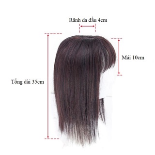Mái hói phủ tóc tơ