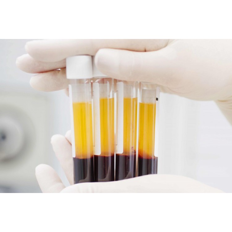 Hộp 100 Ống nghiệm ACD dùng lấy máu chân không trong PRP 8,5ml hàng USA