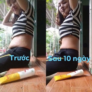 Kem tan mỡ gia truyền (tặng thước dây đo)