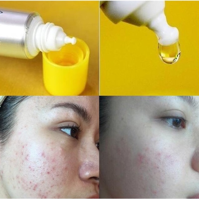 Serum Tinh chất Melano CC dưỡng trắng chống thâm nám Whitening Essence 20ml