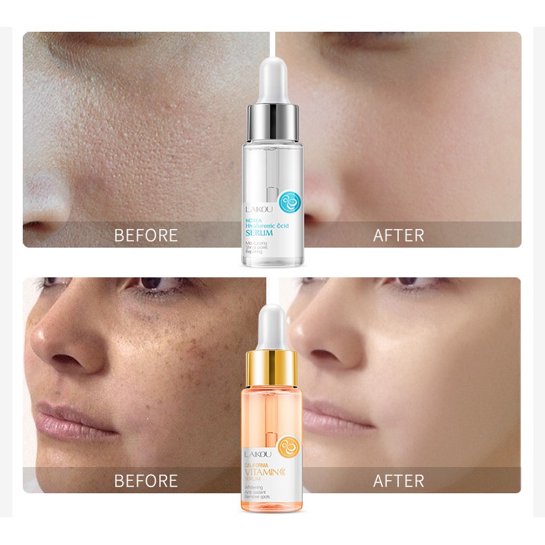 Serum Dưỡng Da Mặt LAIKOU Dưỡng Ẩm Làm Trắng Da, Giảm thâm, Giảm mụn giúp dưỡng ẩm da Hàng Nội Địa Trung