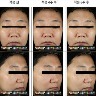 Kem mắt AHC 30ml