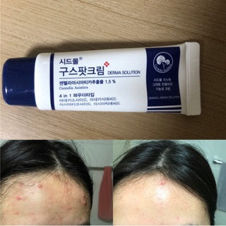 Kem dưỡng da mụn Sidmool centella good spot cream
