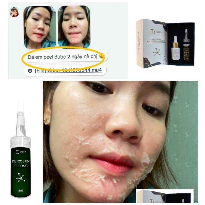 Peel Da Vi Tảo Retinol Trang Nemo Hàng Chính Hãng Hàn Quốc