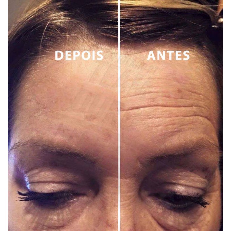 5 ống xóa nhăn tức thì Ageless của Jeunesse | BigBuy360 - bigbuy360.vn