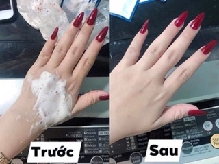[SALE SỐC TRUYỀN TRẮNG] TRUYỀN TRẮNG NANO WHITE