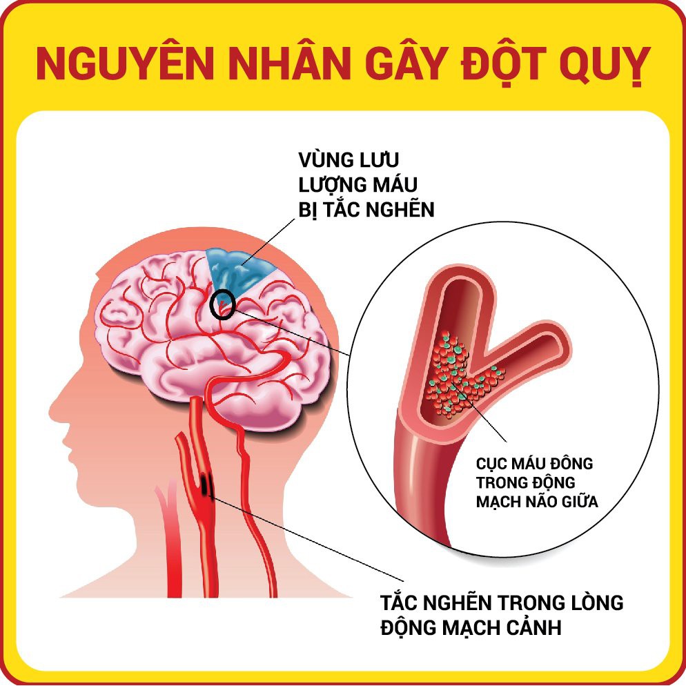 VIÊN DẦU CÁ VITAR FISH OIL 1000MG - HỘP 100 VIÊN - Bổ sung Omega-3, DHA và EPA - TPBVSK | BigBuy360 - bigbuy360.vn