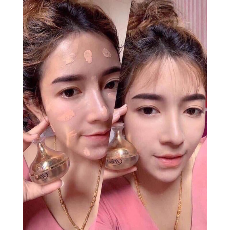 Kem Wise Thái Lan | BigBuy360 - bigbuy360.vn